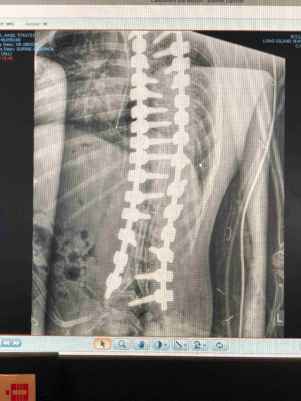 slide (2)